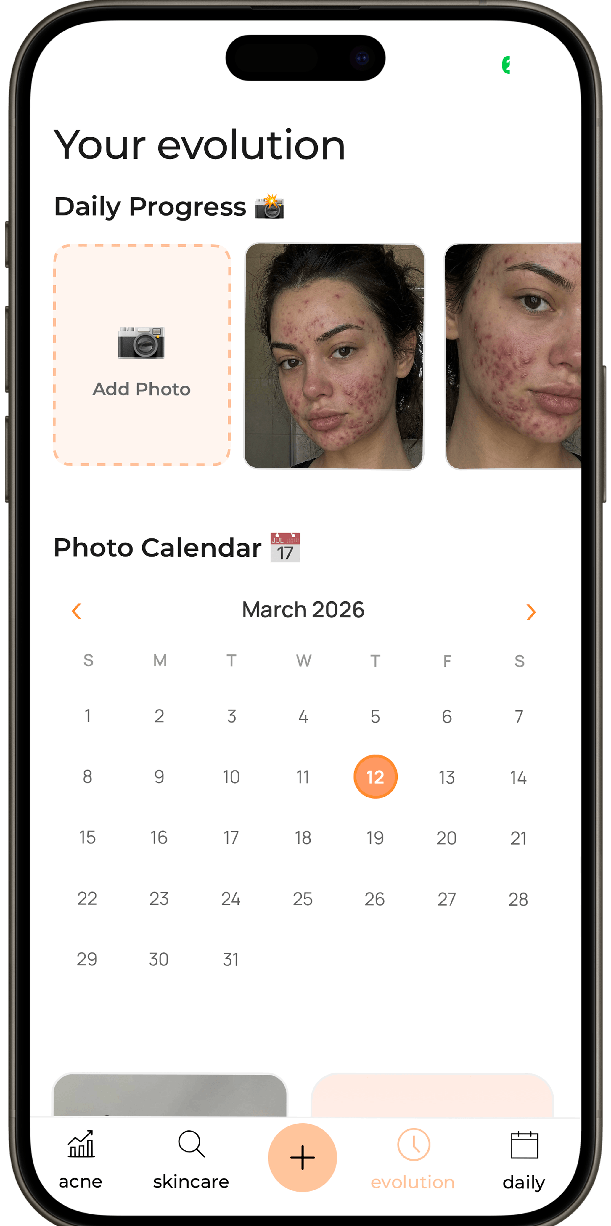 Track your skin evolution