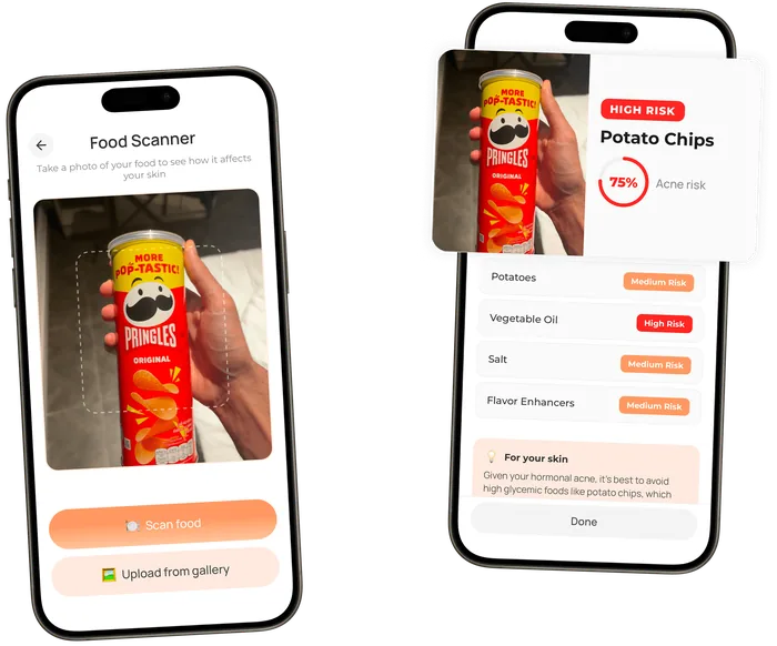 AcneTrack Food Scanner showing how a scanned meal affects acne-prone skin